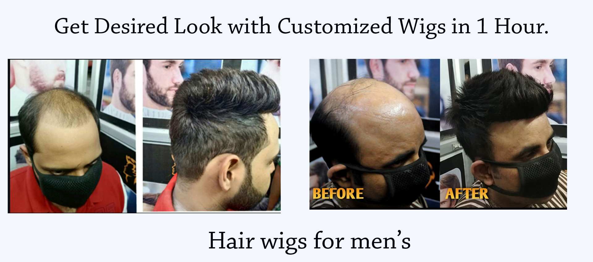 Hair Wigs in Delhi | Hair Patch in Delhi | Kashif Hair Solution Hair Wigs in Delhi | Hair Patch in Delhi | Kashif Hair Solution